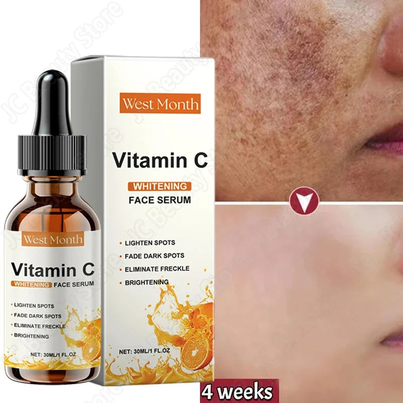 Vitamin C Whitening Serum - Care Essentials