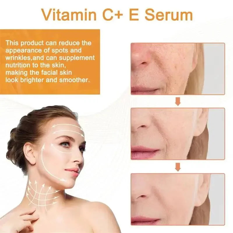 Vitamin C Whitening Serum - Care Essentials 