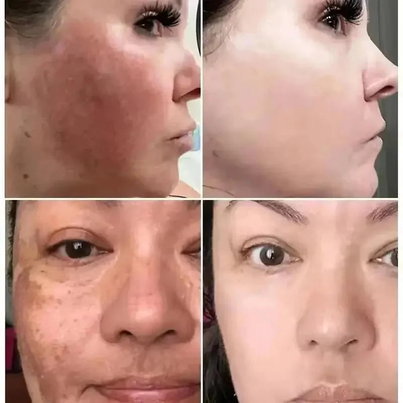 Vitamin C Whitening Serum - Care Essentials 